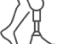 Joint Replacement Rehabilitation